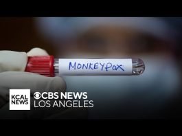 LA County Public Health officials report "concerning increase" in monkeypox cases